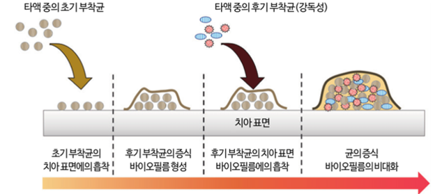 치아 세균막 형성 과정