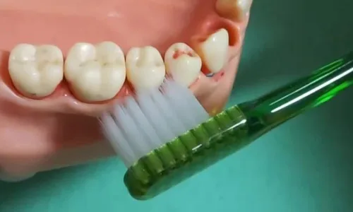 치아 모형에 칫솔을 대고 칫솔질하는 모습